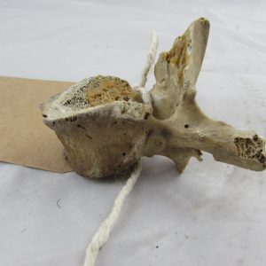 Real Human Vertebra Bone" medical specimen"