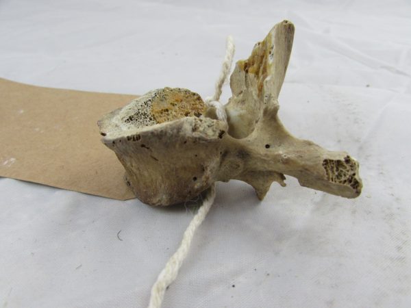 Real Human Vertebra Bone" medical specimen"