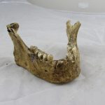 Real Human Jawbone, medical specimen